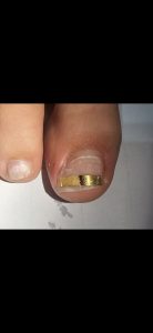 קורס אורטוניקסיה מקצועי 